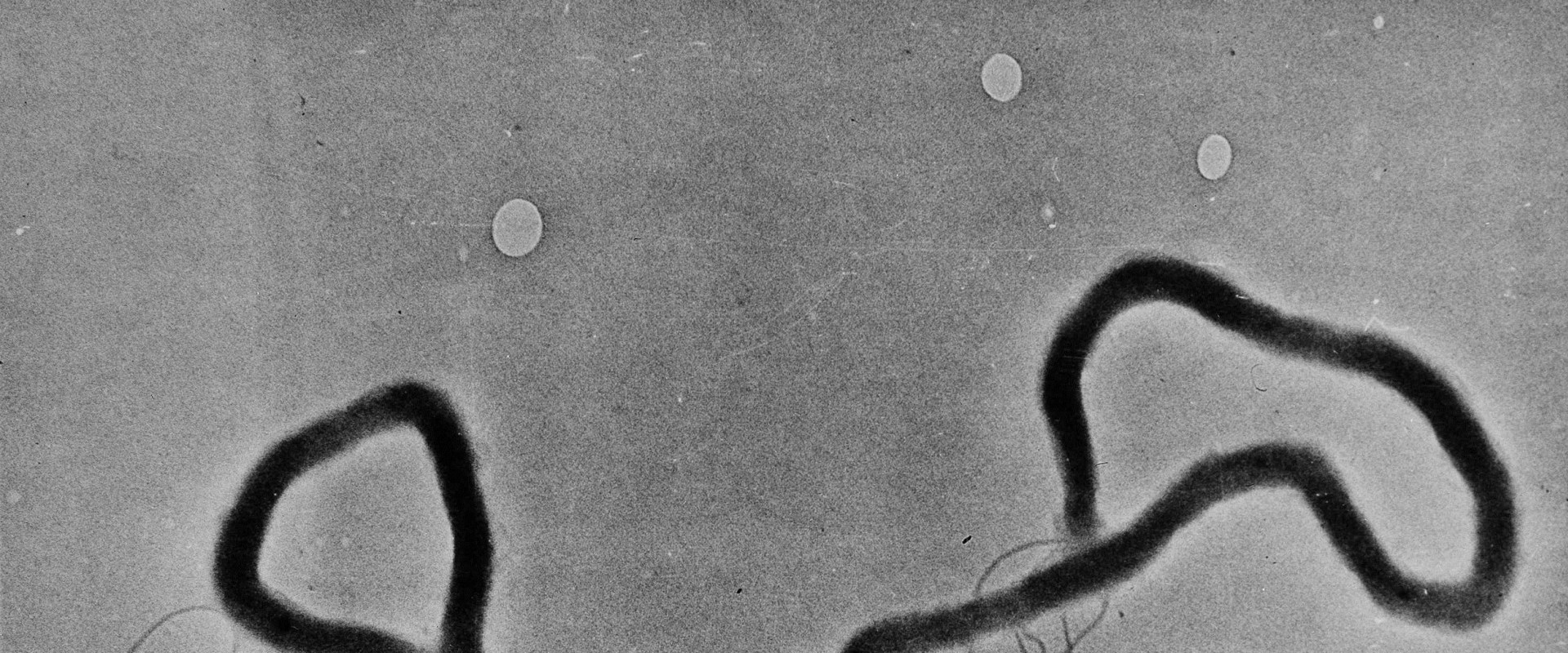 The Shift from STDs to STIs: Why the Change and What it Means