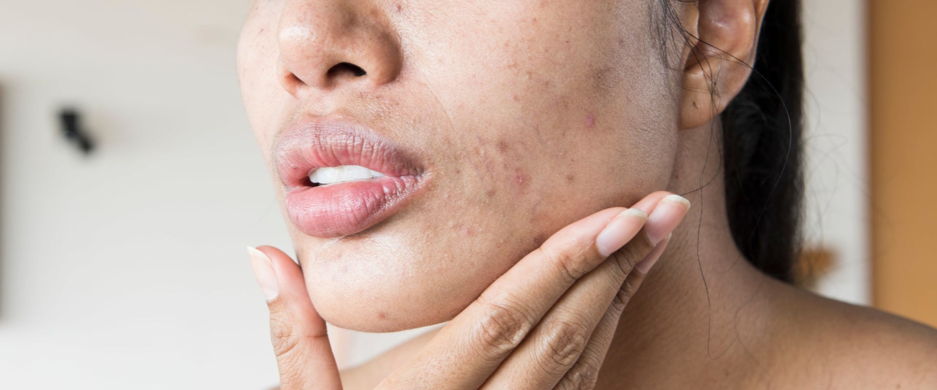 The Surprising Connection Between STDs and Cold-Like Symptoms