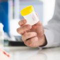 The Dangers of Leaving an STD Untreated