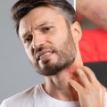 Can You Get STDs Through Skin Contact?
