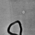 The Shift from STDs to STIs: Why the Change and What it Means