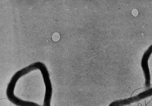 The Shift from STDs to STIs: Why the Change and What it Means