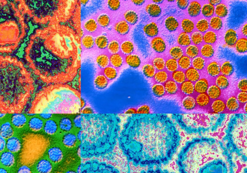 The Truth About STD Transmission: An Expert's Perspective